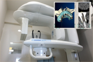 インプラント治療を安全に行うための歯科CT撮影装置。